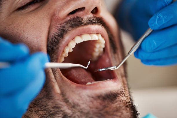 Best After-Hours Dental Trauma Care in Berry Creek, CA